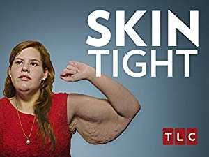 Skin Tight - TV Series