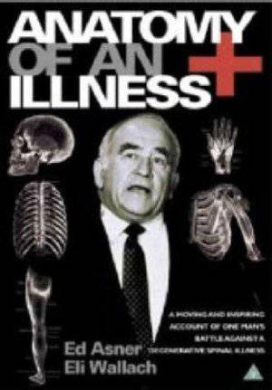 Anatomy of an Illness - Amazon Prime