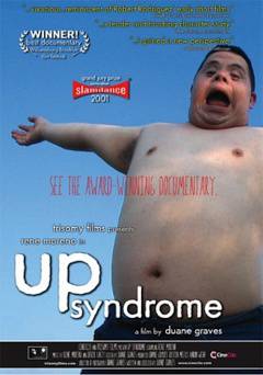 Up Syndrome - amazon prime