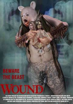 Wound - Amazon Prime