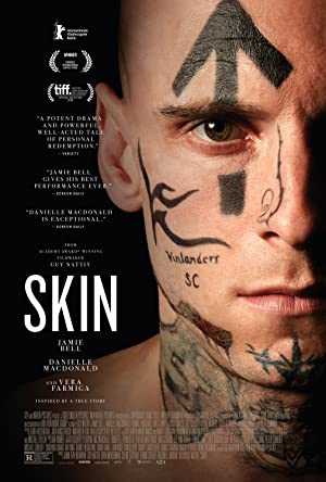 Skin - netflix