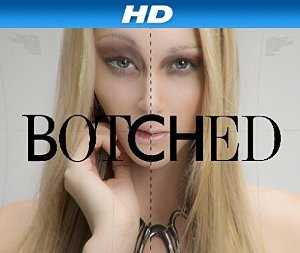Botched - TV Series
