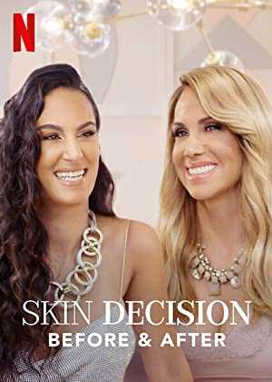 Skin Decision: Before and After - netflix