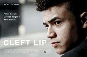 Cleft Lip