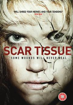 Scar Tissue - SHOWTIME