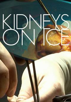 Kidneys on Ice - Amazon Prime