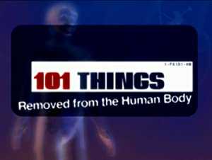 101 Things Removed from the Human Body - amazon prime